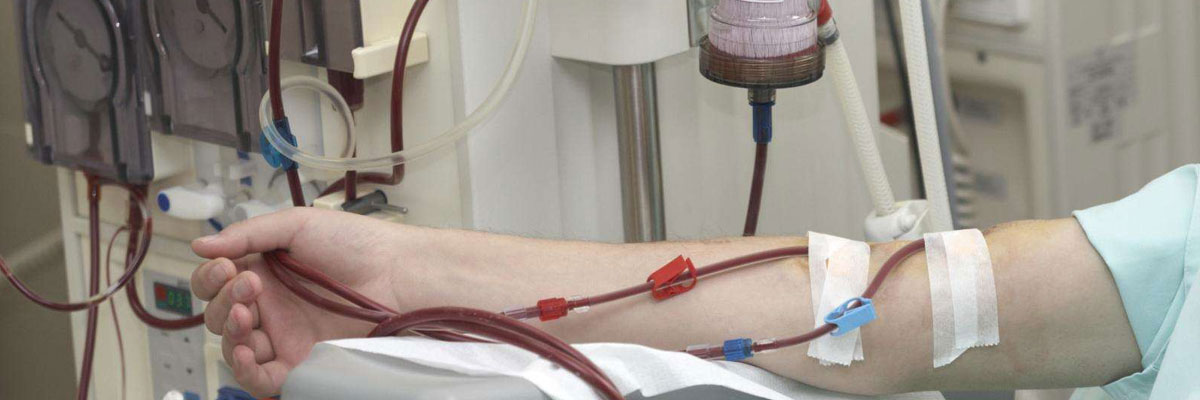 Vascular Access For Dialysis